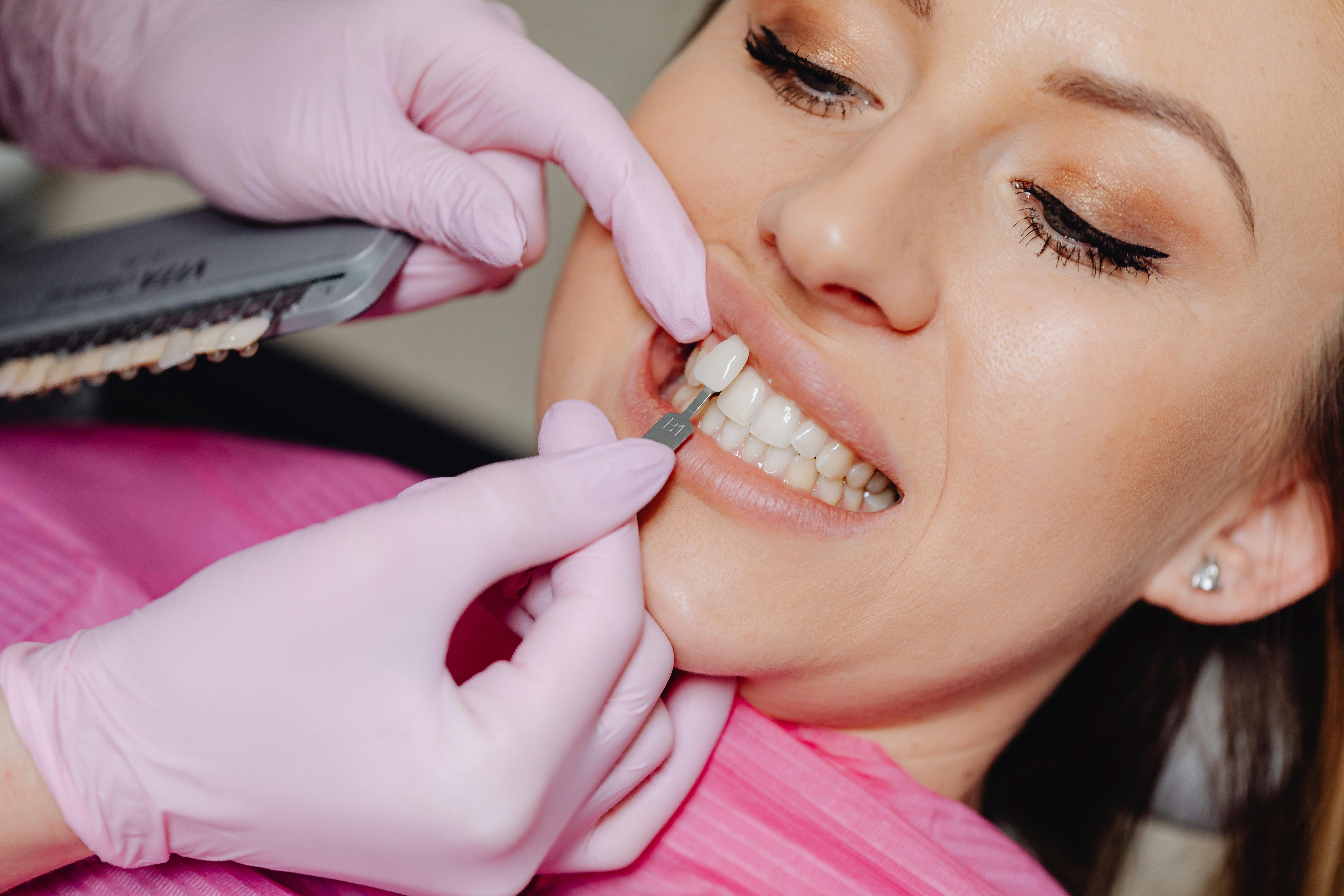 Sleep Dentistry for Cosmetic Veneers
