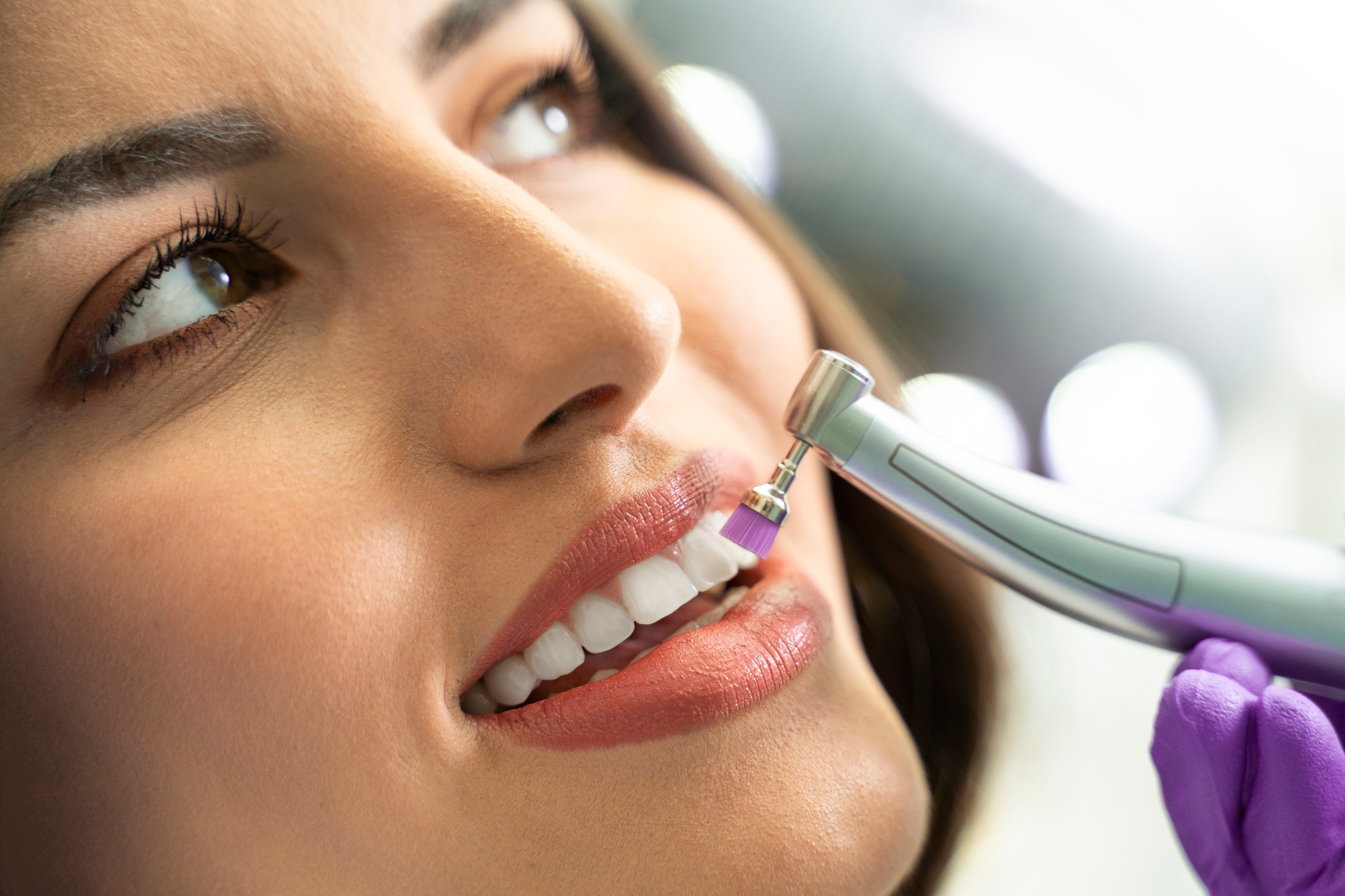 Sleep Dentistry for Tooth-Coloured Fillings